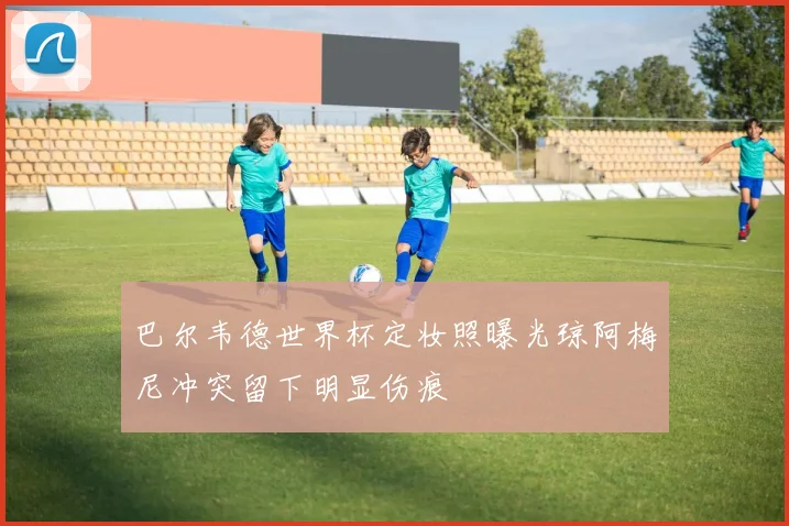 巴尔韦德世界杯定妆照曝光琼阿梅尼冲突留下明显伤痕